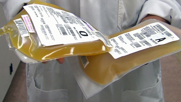 輸血為何是黃色的，了解「成分輸血」種類 12