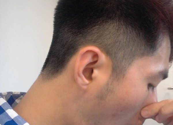 流鼻血了-該如何有效止血？ 11