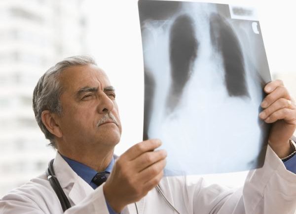 長期咳嗽不止，醫生為何要你做肺功能檢查 1